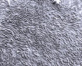 Filtry membranowe ipCELLCULTURE™ z wytrawionym śladem